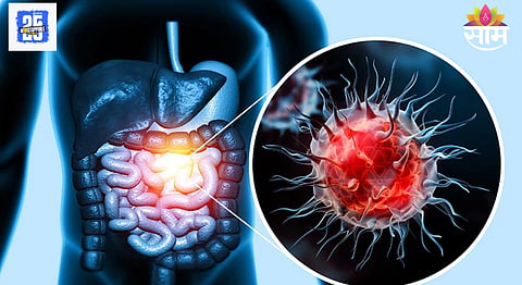 New Cancer Treatment Research