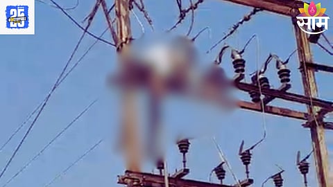 Electricity Shock