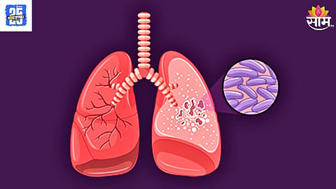 World Tb Day