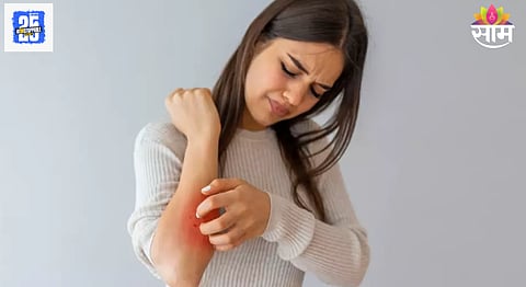 Skin allergy: किती आहेत त्वचेच्या अॅलर्जीचे प्रकार? जाणून घ्या परिणाम आणि घरगुती उपचार
