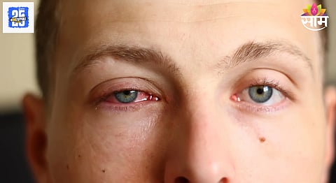 pink eyes problems