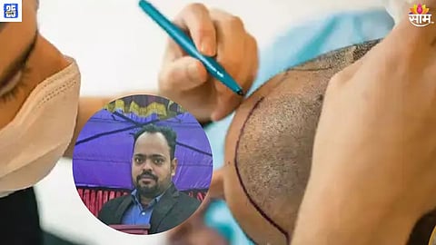 hair transplant vinita dubey death