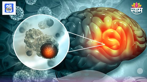 Brain Tumor Early Symptoms