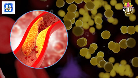 High cholesterol no symptoms dangerous
