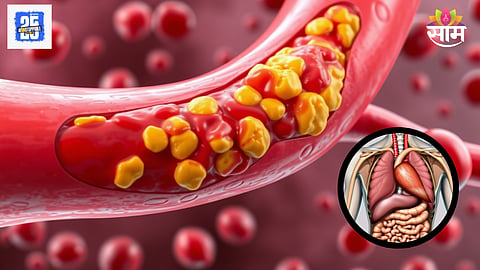 High Cholesterol affects Body
