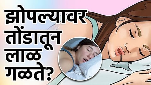 Surya Remedies