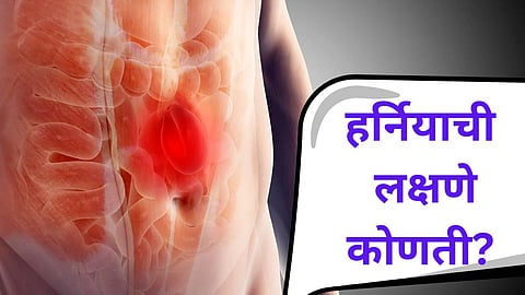 hernia awareness
