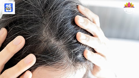 Gray hair