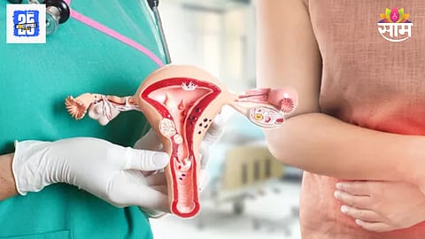 Hysterectomy effects