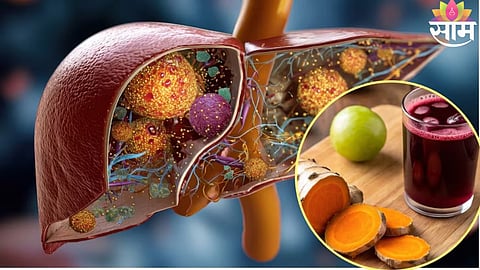 Natural Liver Detox