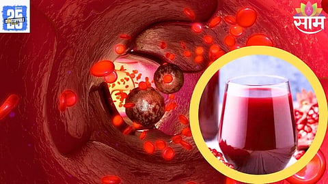 foods causing colon cancer