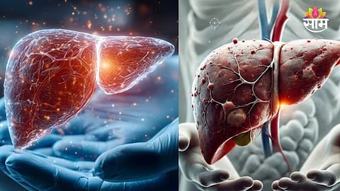 Liver Problems