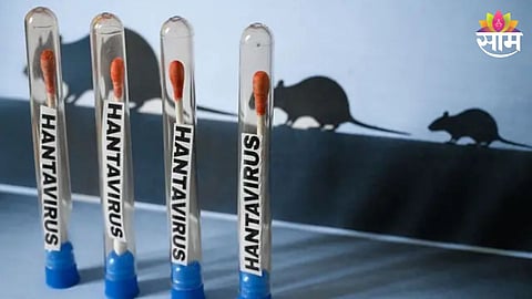 Hantavirus