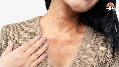 Dark Neck Skin