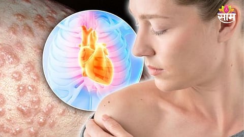 Heart disease symptoms