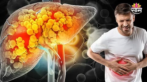 Fatty Liver Disease