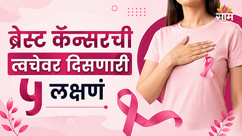 Breast Cancer Symptoms