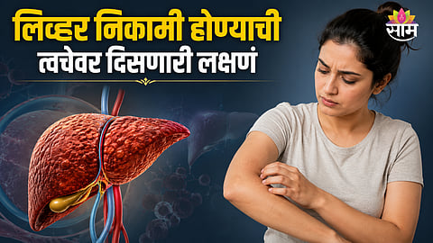 Liver disease