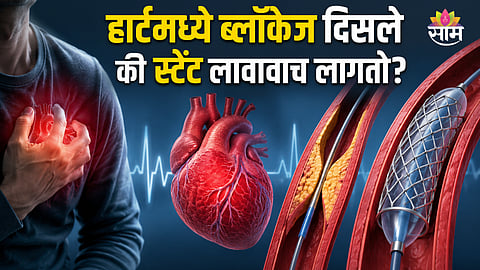 Heart blockage
