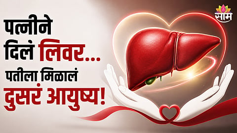 Liver transplant