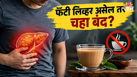 Fatty liver and tea: फॅटी लिव्हर असल्यास चहा पूर्णपणे बंद करावा का? डॉक्टरांनी सांगितलं नेमकं सत्य