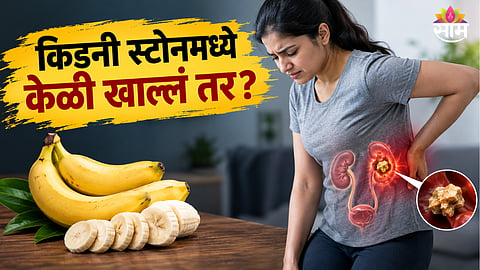 Banana for kidney stones