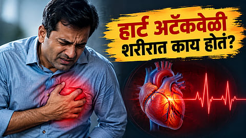 Heart attack symptoms