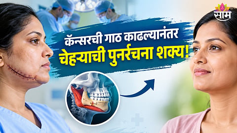 Jaw reconstruction surgery