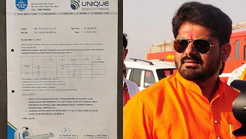 Thousands of rupees have been asking for a test of HRCT center in Beed
