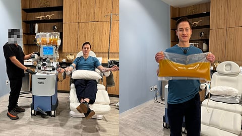 plasma treatment