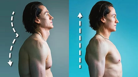 bad posture