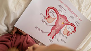 Cervical Cancer