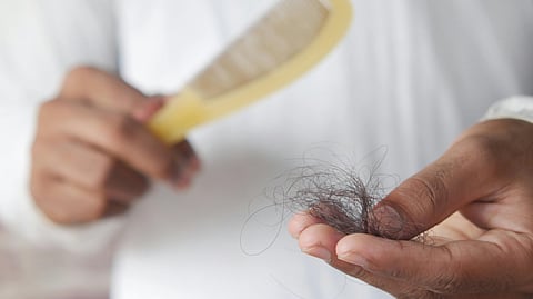 hair loss