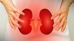 KIDNEY STONE
