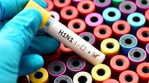 h1n1,Influenza