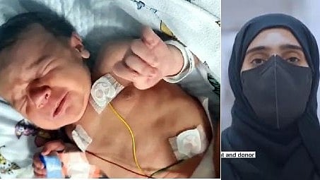 UAE liver transplant