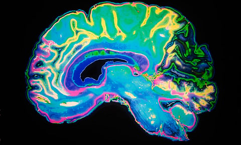 Image of Brain