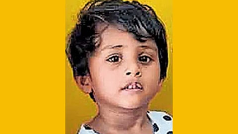 medical negligence
