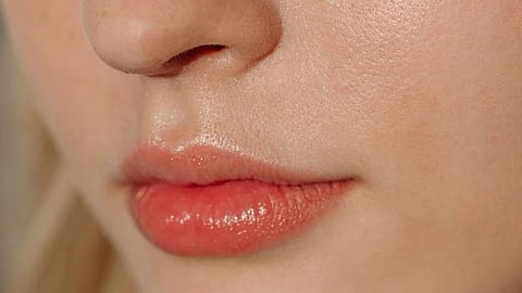 Lip Care