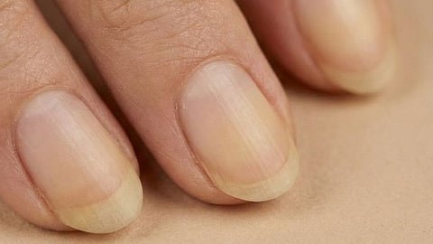 Nails