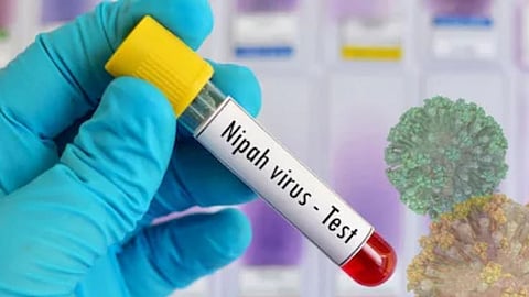 Nipah Virus: Pune NIV Confirms Positive Result for Patient in Kerala