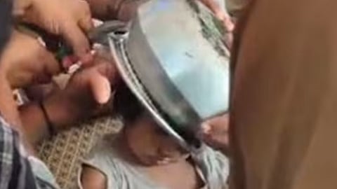 Fire force successfully extricated an aluminum pot from the head of a two-year-old girl