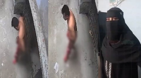 Wife cuts husband's penis after a family dispute.
