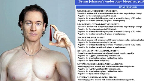 Bryan Johnson Autoimmune dieseases