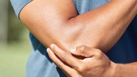 Tennis Elbow symptoms