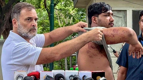 Pellet Victim By His Side, Rahul Gandhi Targets Centre