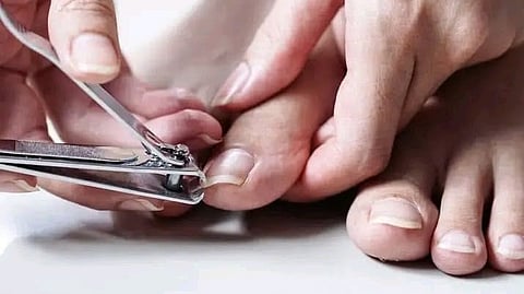Nail cutting
