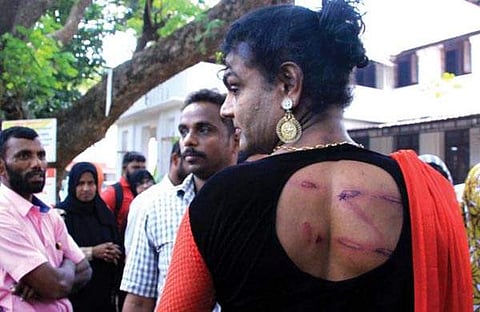 ട്രാന്സ്ജെന്ഡറുകളെ തല്ലിക്കൊല്ലുമോ കേരളം?