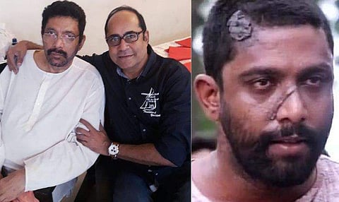 'കീരിക്കാടന് ആരുടേയും സാമ്പത്തിക സഹായം ആവശ്യമില്ല'; മോഹന്രാജിനെ ആശുപത്രിയിലെത്തി സന്ദര്ശിച്ച് ദിനേശ് പണിക്കര്
