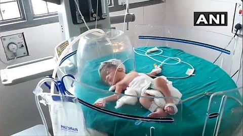 നെഞ്ചുപിളര്ക്കുന്ന ക്രൂരത!; നവജാതശിശുവിനെ സ്ത്രീ ഓവുചാലിലേക്ക് വലിച്ചെറിഞ്ഞു, രക്ഷയ്ക്ക് എത്തി തെരുവുപട്ടികള്; നടുക്കുന്ന കഥ